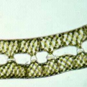 Jochbildung bei der Schraubenalge Spirogyra © Prof. Dr. Else-Lore Kusel-Fetzmann 