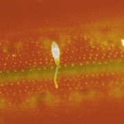 Auskeimende Sporen eines Pilzes auf einem behandelten Reisblatt Bayer AG 